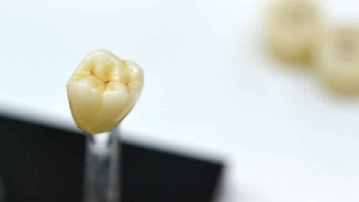 Dental Crowns Grapevine
