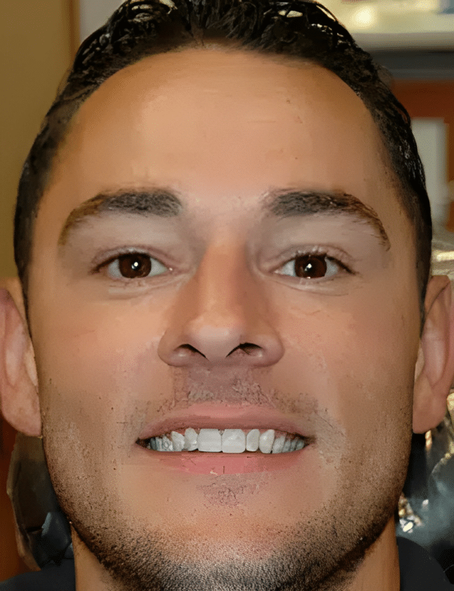 Man smiling at camera displaying dental work in indoor setting