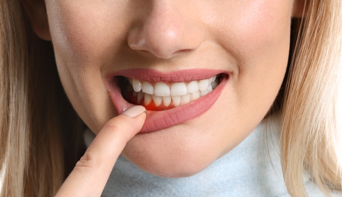 Woman smiling brightly, touching her lip, displaying healthy white teeth in close-up portrait.