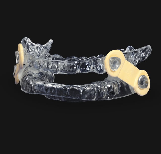Clear orthodontic expander device with yellow adjustment wheels on black background.