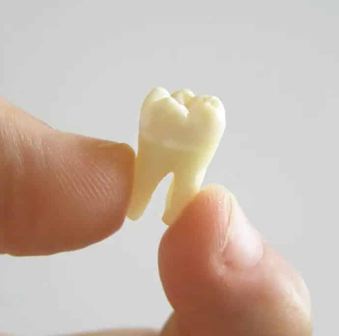 Extracted tooth held between fingers against neutral background, dental specimen display.
