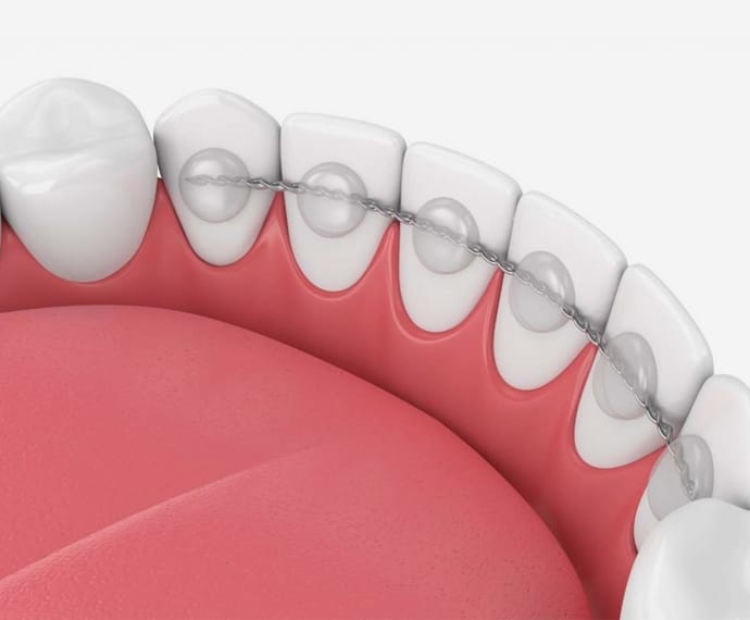 Upper teeth and gum line showing dental anatomy in cross-section illustration.